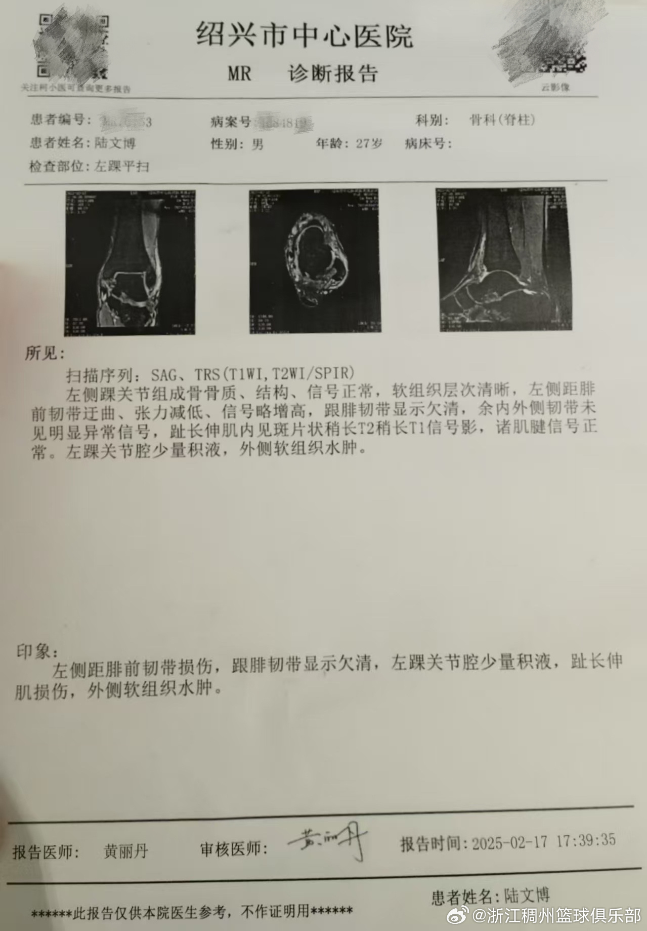 项目上